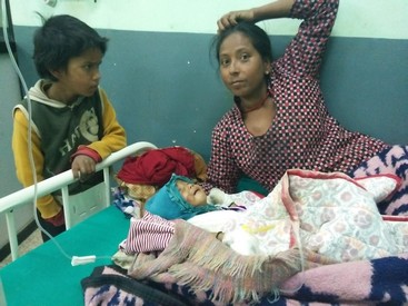 ७ महिने शिशु अस्पतालको शैयामा छटपटिदै, आर्थिक समस्या उपचारको बाधक
